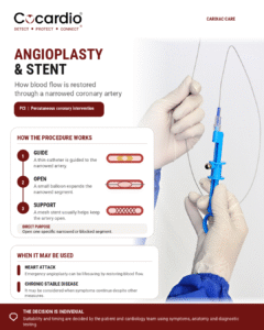 ECP/EECP® vs Angioplasty and Stents: What Is the Difference? 
