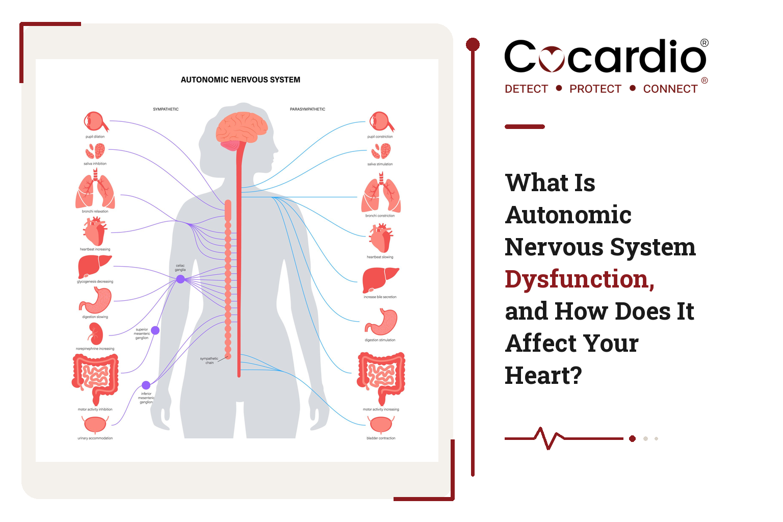 What Is Autonomic Nervous System Dysfunction, and How Does It Affect Your Heart?
