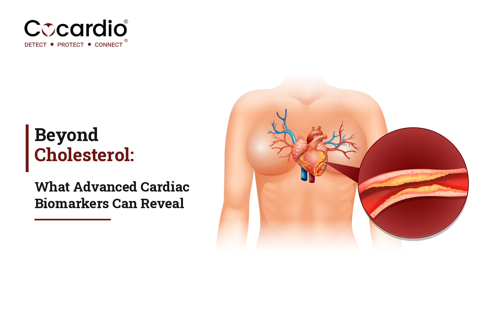 Beyond Cholesterol: What Advanced Cardiac Biomarkers Can Reveal